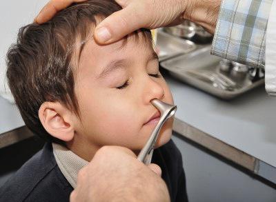 We get rid of the cold. How do children wash their nose with saline solution?