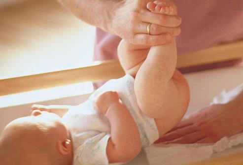 How many times should a newborn have a chair? Watery stool in a newborn