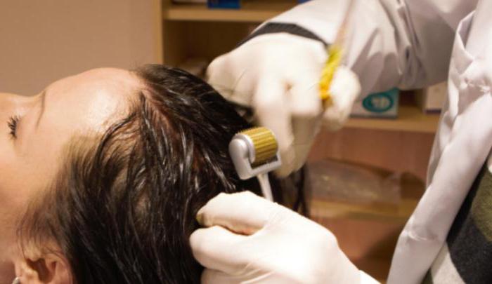 technique of meso-therapy of the scalp