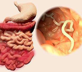 White worms in feces. Pinworms in children: symptoms and treatment