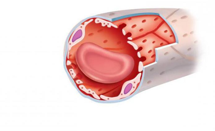 What distinguishes the arteries from the veins: the features of the structure and functioning