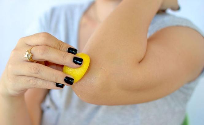 Black Elbow: what to do to become beautiful again?