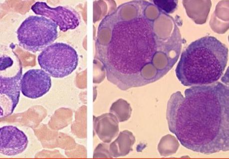 What is a cytogram of inflammation?