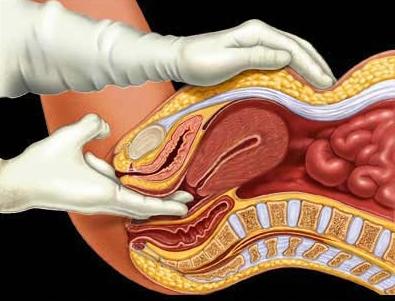 what is cervical erosion