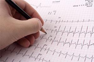 ECG: the norm of basic indicators