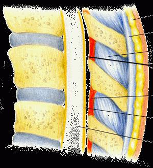 Epidural: what is it?