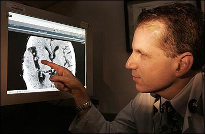 Stroke. Treatment medication