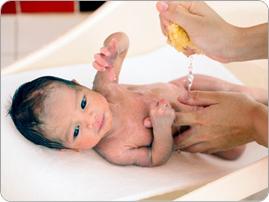 How the navel is treated correctly in a newborn