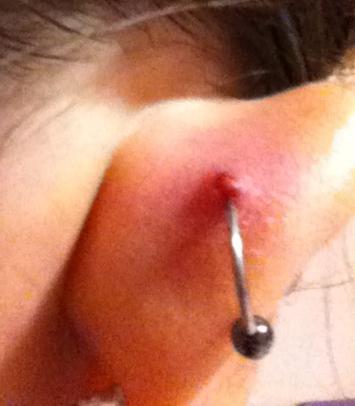 How is the piercing of the ears: is the cartilage injured or not?