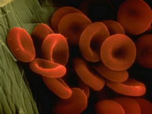 the norm of hemoglobin in the blood of women