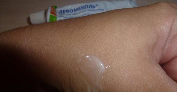 Ointment "Levomekol". What is it for?