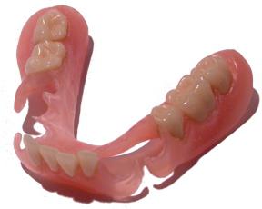 Nylon dentures cost