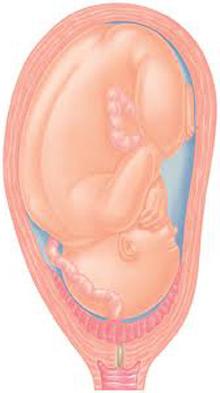 low placental location