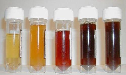 elevated erythrocytes in the baby's urine