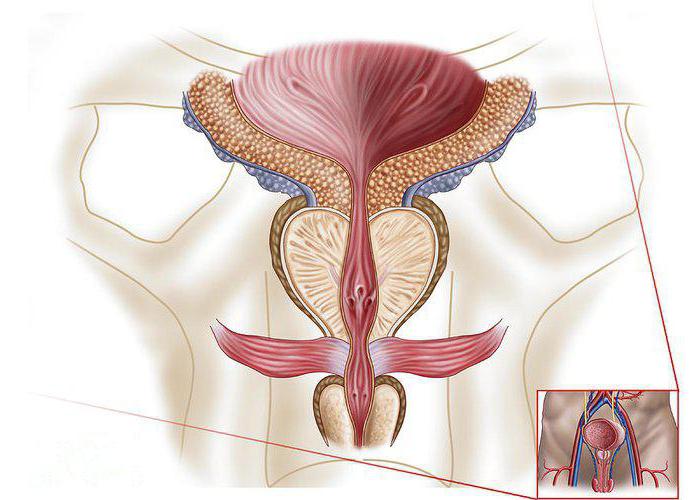 Consequences of chronic prostatitis