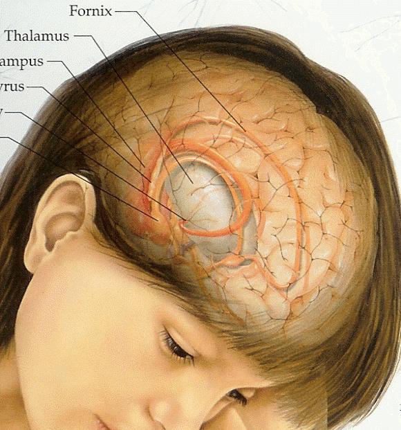 brain tumor symptoms at an early stage