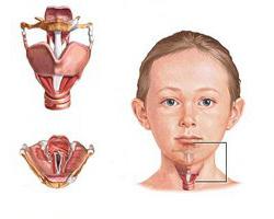 Features of the use of the drug "Tantum Verde" for children