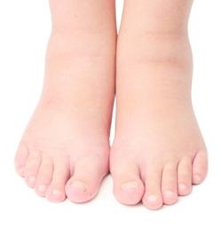 Swelling of the feet of the feet causes