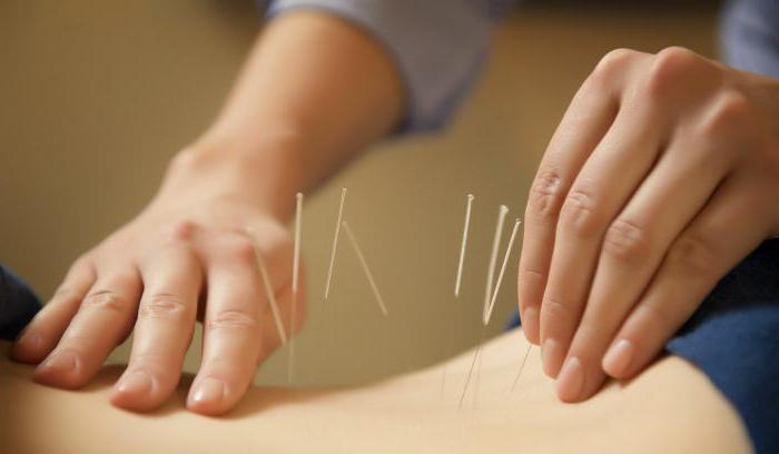 the benefits of acupuncture