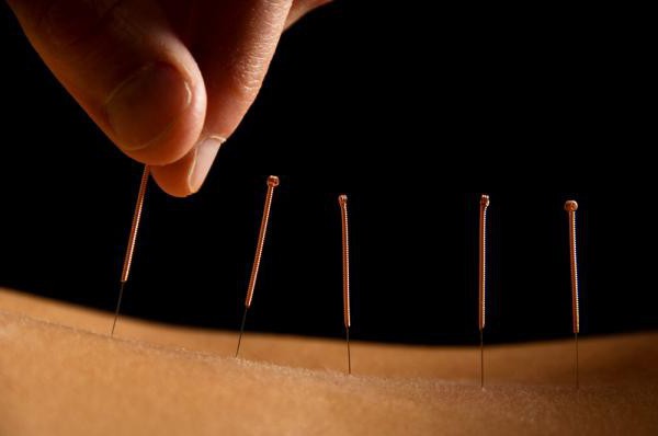 acupuncture is good and bad