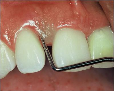  periodontitis medical history