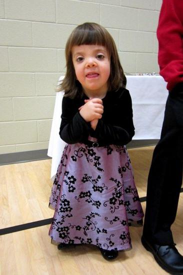 Noonan Syndrome: Description, signs, treatment