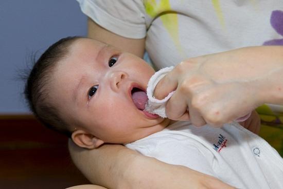 why the child has a yellow coating on the tongue